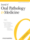 JOURNAL OF ORAL PATHOLOGY & MEDICINE雜志封面